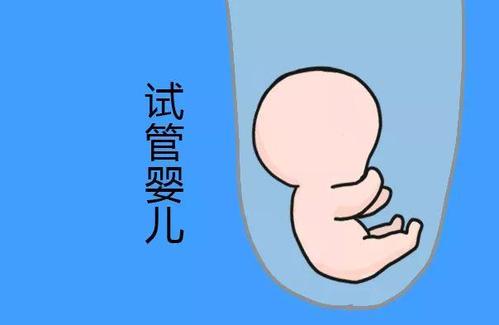 体外受精 IVF-ET